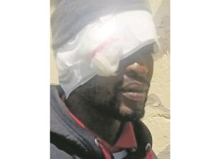 Noiva virgem foge da Lua de Mel após se assustar com o tamanho do pênis de seu marido