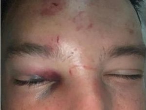 Meia da seleção inglesa é espancado após tentar sair com esposa de outro jogador