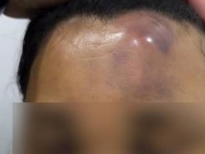 Polícia investiga conduta de militares denunciados por agredir mulher em Maceió
