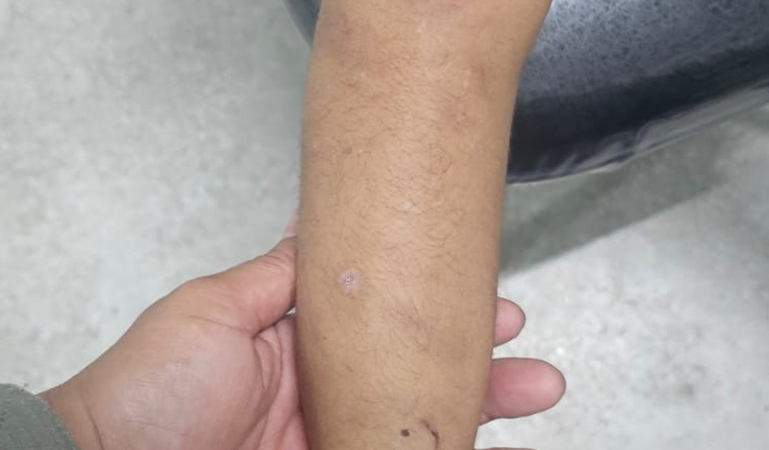 Trauma e hematomas: menino vítima de maus-tratos em Maceió é entregue ao pai