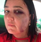 Mulher é agredida por eleitores de Bolsonaro após declarar voto em outro candidato em Maceió