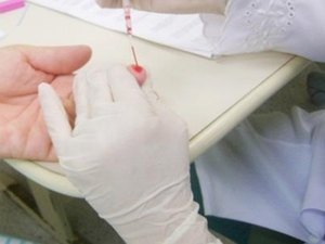 Hospital Helvio Auto fará testes para detectar Hepatites B e C