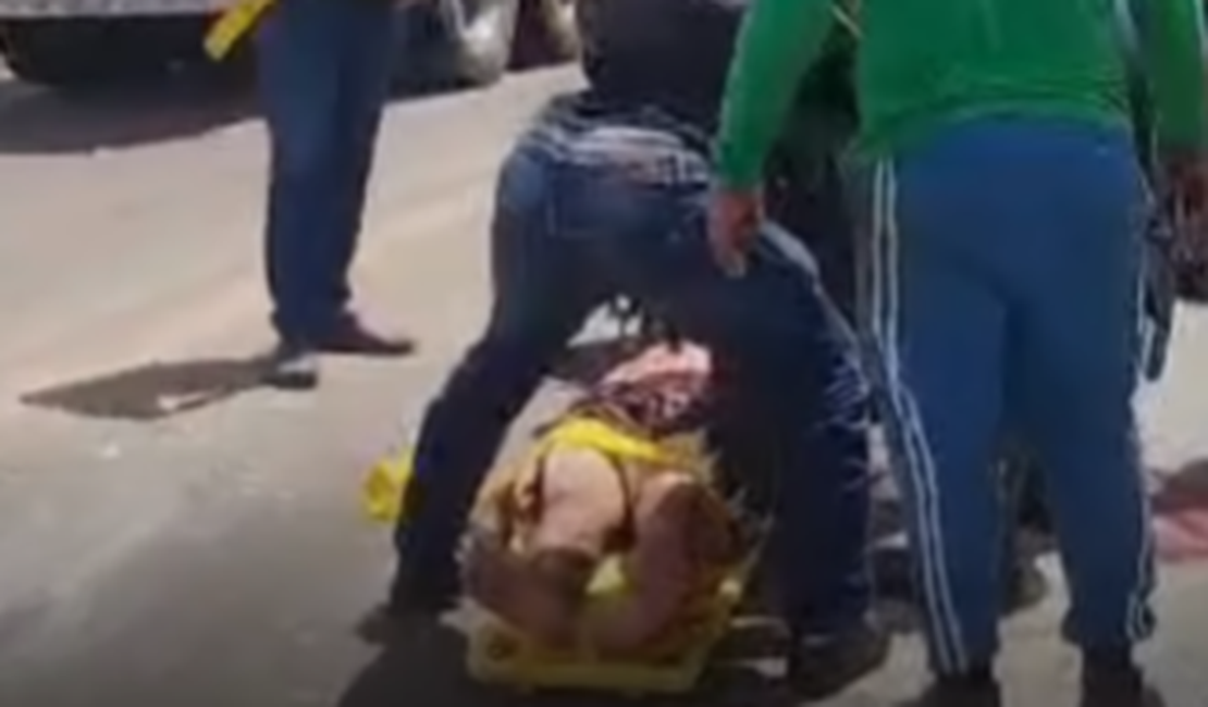 Motociclista fica ferido após colisão com caçamba na AL-110, em São Sebastião