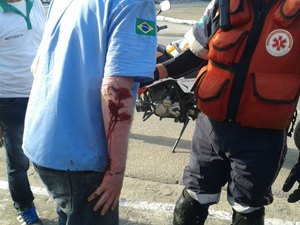 Motociclista fica ferido ao colidir em veículo