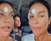 Ivete Sangalo faz cirurgia no maxilar após queda em casa; saiba como está a cantora