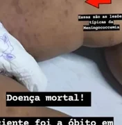 HGE confirma morte de bebê de um ano por meningite