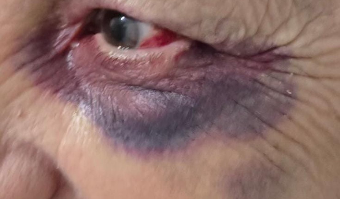 Filho é preso suspeito de agredir a mãe de 72 anos no município de Palmeira dos Índios