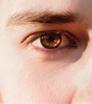 Trend nas redes, raspar os cílios pode causar lesões nos olhos