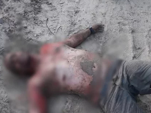 Para não morrer, arapiraquense se fingiu de morto após ter corpo queimado por criminosos 