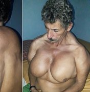 [Vídeo] Homem sofre de doença misteriosa que faz crescer os músculos