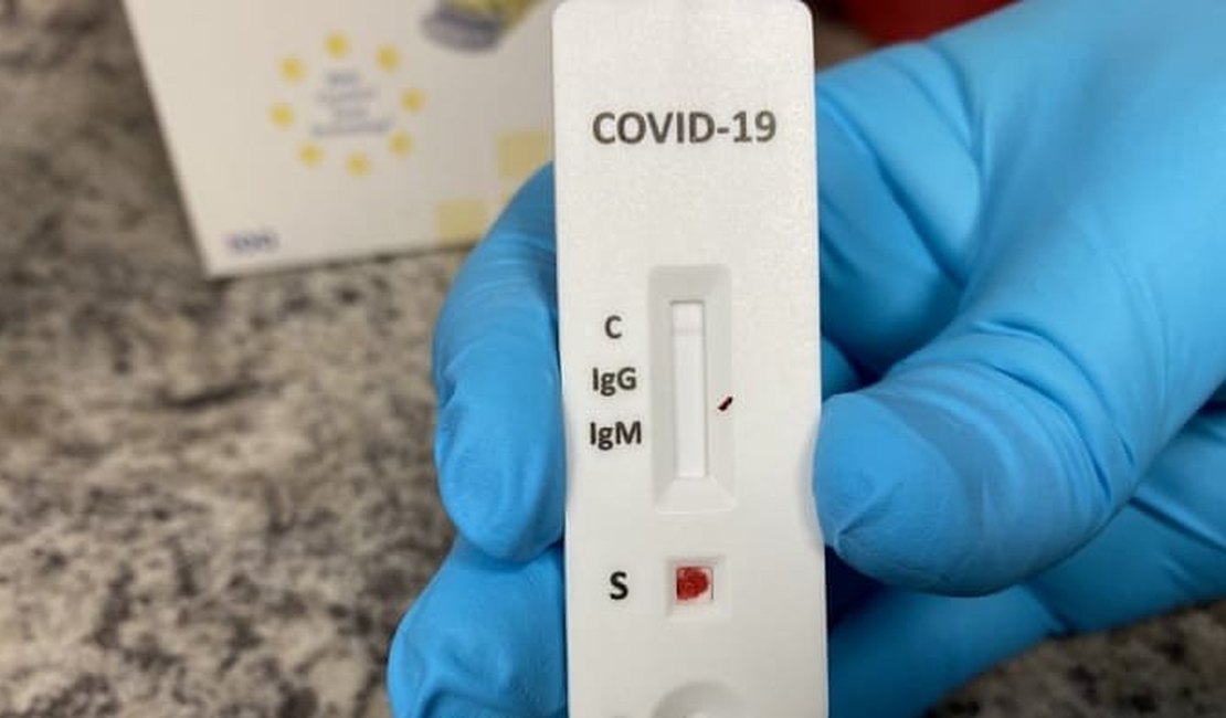 Covid-19: Quase 300 pessoas testam positivas em exames de farmácias em AL