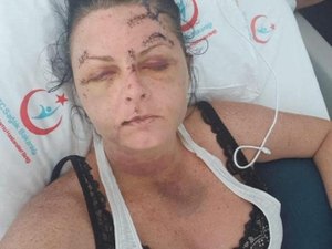 Turista é espancada por homem depois de se recusar a fazer sexo com  o agressor