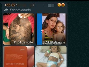 Golpista usa matéria do 7Segundos se passando por mãe que pede ajuda para custear tratamento do filho