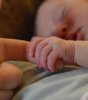 Bebê desenvolve genitália masculina após contato com gel hormonal do pai