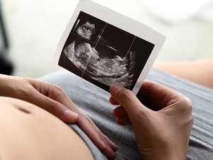 Troca de gêmeos em maternidade gera reflexões sobre a importância da ultrassonografia no Pré-natal