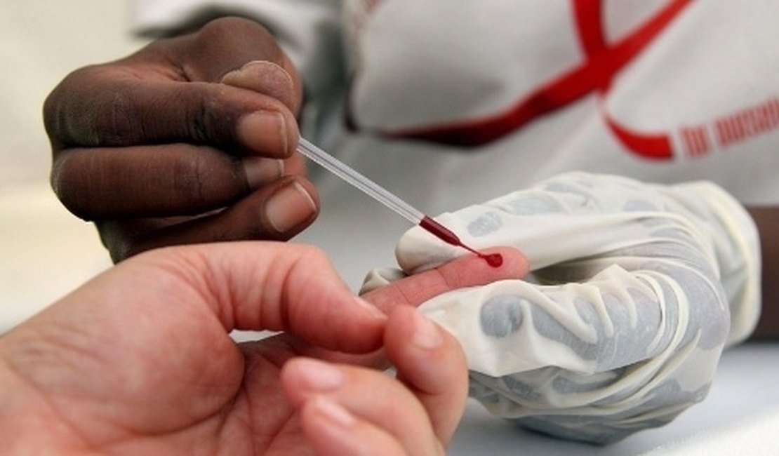 Brasil tem 827 mil vivendo com HIV; 112 mil não sabem que estão infectados