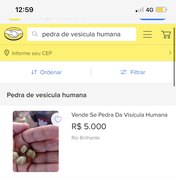 Brasileiros utilizam plataformas de venda online para comercializar pedras de vesícula