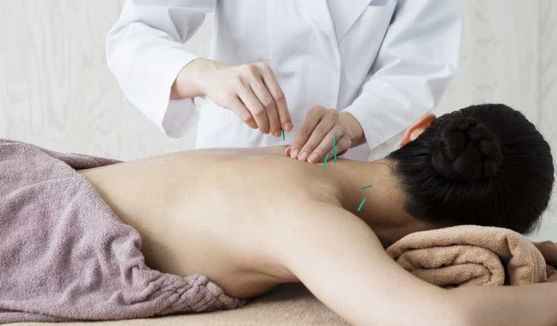Conselho de Farmácia repudia declaração de médica sobre restrição da acupuntura