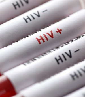 Fiocruz fabricará remédios contra HIV e hepatite C para ofertar no SUS
