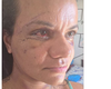 Mulher espancada com mais de 60 socos mostra rosto após cirurgia para reconstrução facial