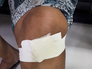 Homem vê assalto, reage e acaba atirando em moradora no Pilar