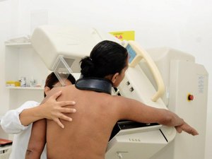Sesau destaca importância do diagnóstico precoce de câncer de mama