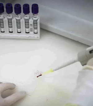 Paciente em SP com suspeita de ebola testa positivo para meningite