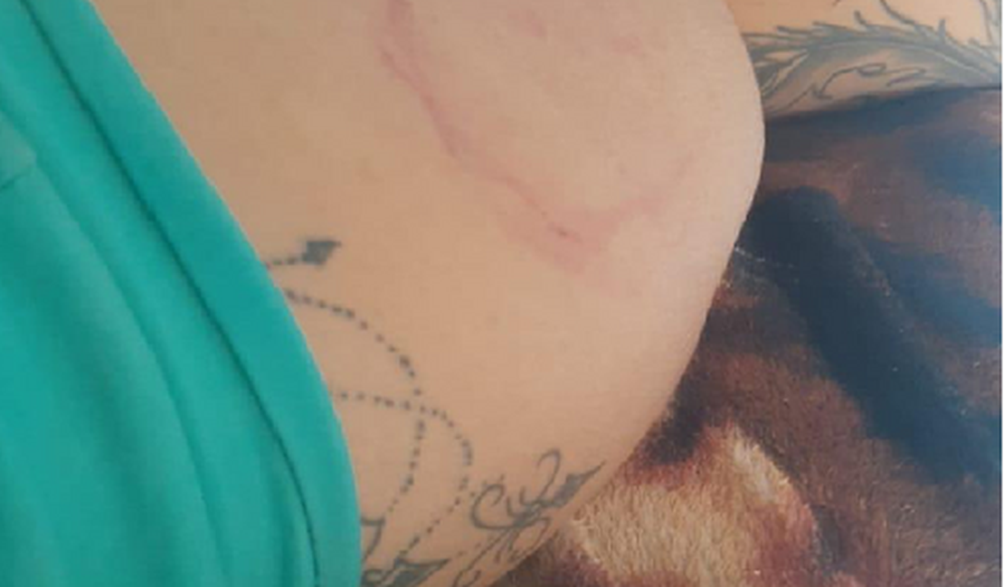 Grávida denuncia companheiro por homicídio e é agredida a tijoladas em Maceió