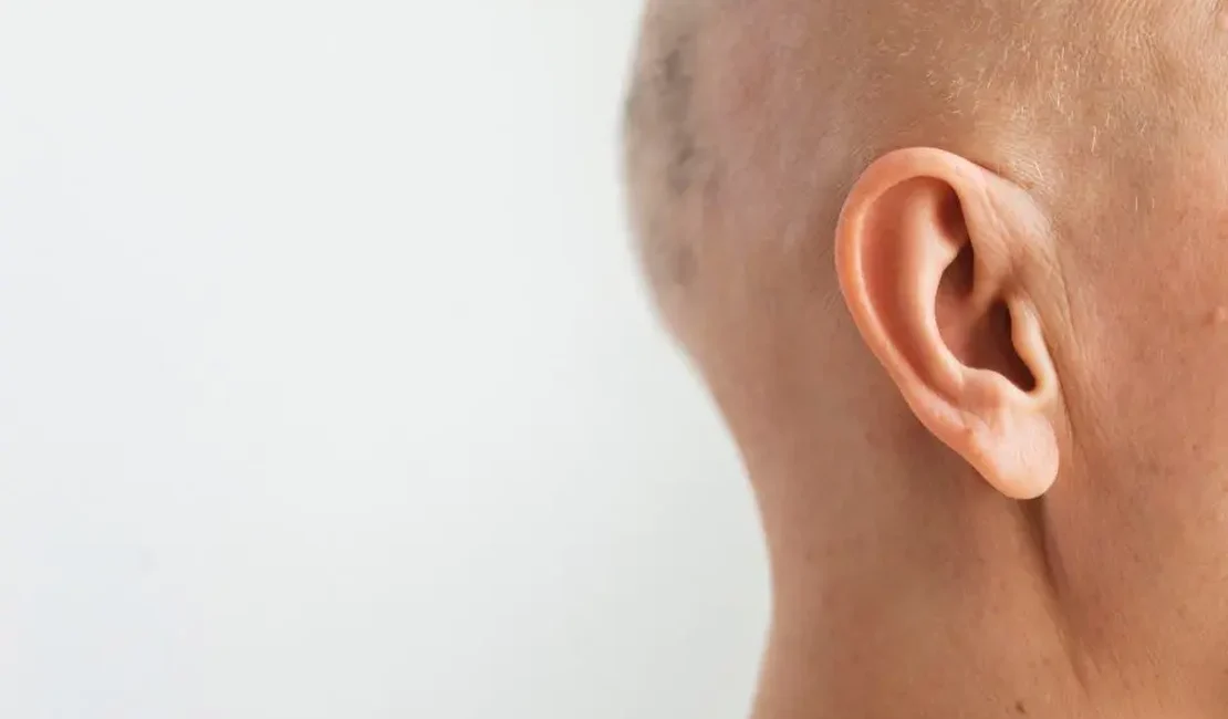 Homem arranca as próprias orelhas para simular tortura e voltar para ex, mas polícia descobre farsa