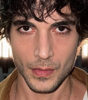 Fiuk aparece com rosto machucado após polêmica com música sobre o pai