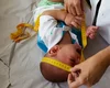 INSS pagará indenização de R$ 60 mil a crianças vítimas de zika