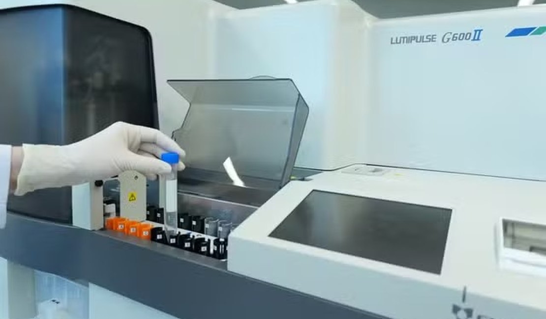Exame de sangue para Alzheimer chega ao Brasil; veja quanto custa