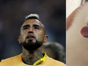 Arturo Vidal oferece recompensa milionária por cão desaparecido