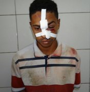 Assaltante é agredido por populares e preso após roubar celular de mulher no Jaraguá