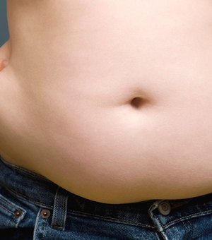 Obesidade aumenta em até 4 vezes o risco de morrer por Covid, indica estudo