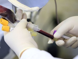 Varíola dos macacos: Anvisa faz recomendações sobre doação de sangue