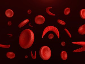 Brasileiros desconhecem a Doença Falciforme, enfermidade hereditária de maior prevalência no país