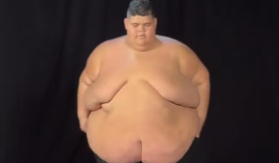 [Vídeo] Gordão da XJ mostra antes e depois de perder 130 kg