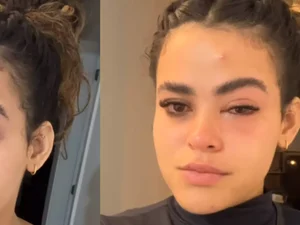 'Mosquinha parece ser inofensiva, mas não é', diz jovem que viralizou após infecção ocular